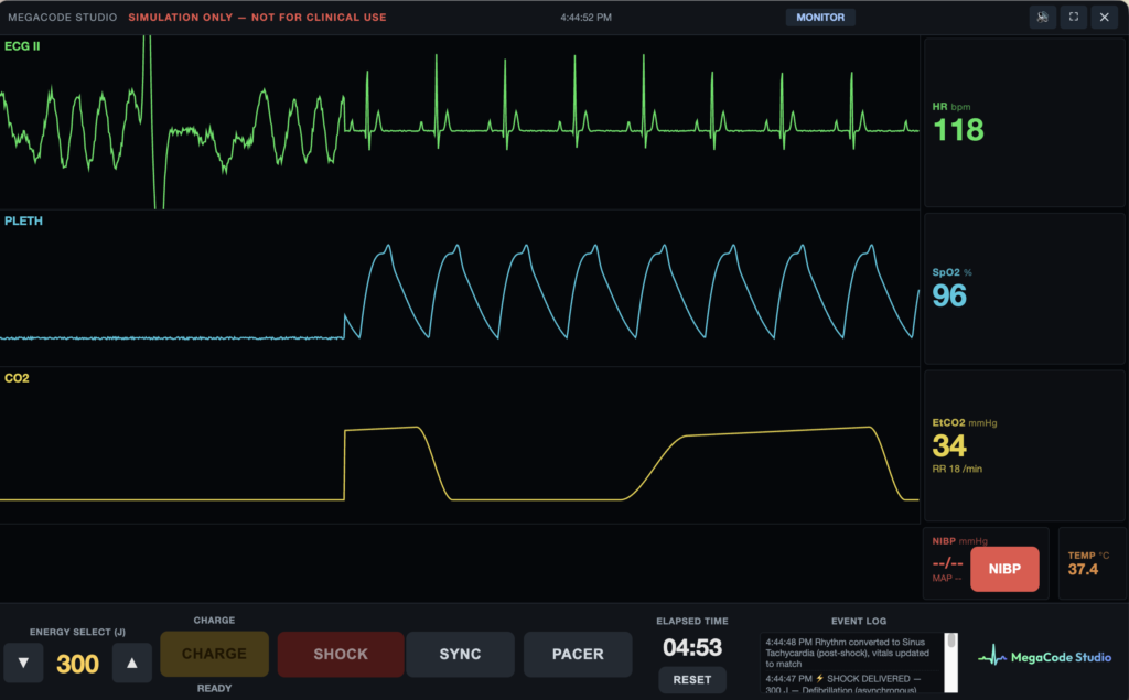 Defibrillation