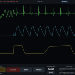 Defibrillation